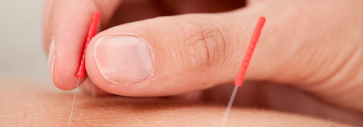 acupuncture3 acupuncture